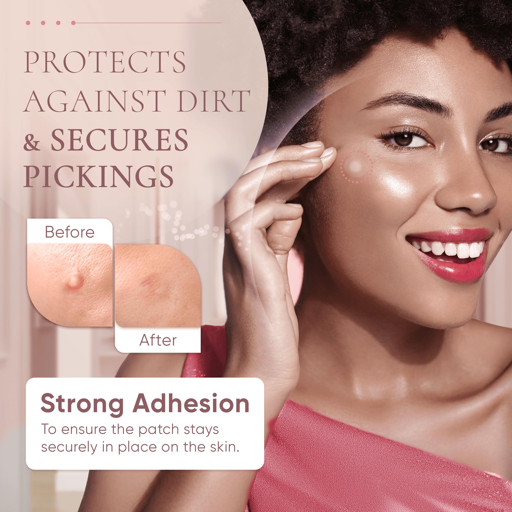 Prime Patch - Hydrocolloid Pimple Patches for Face, Clear Zit Stickers & Acne Dots, Strong Adhesion, Ultimate Blemish & Acne Pat