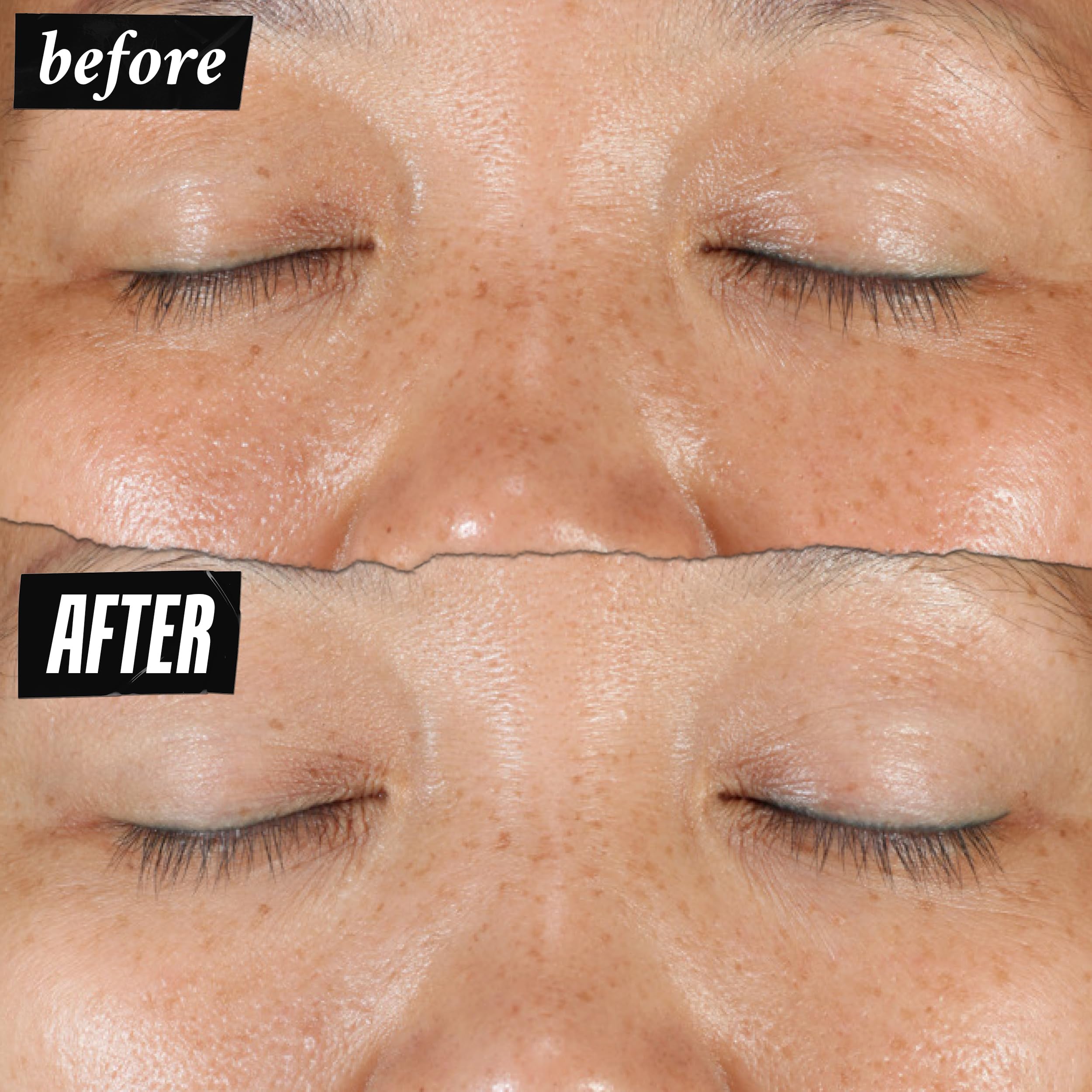 Kiehl'S Clearly Corrective Dark Spot Serum, Brightening Facial Serum, Reduces Hyperpigmentation & Post-Acne Marks, With Vitamin