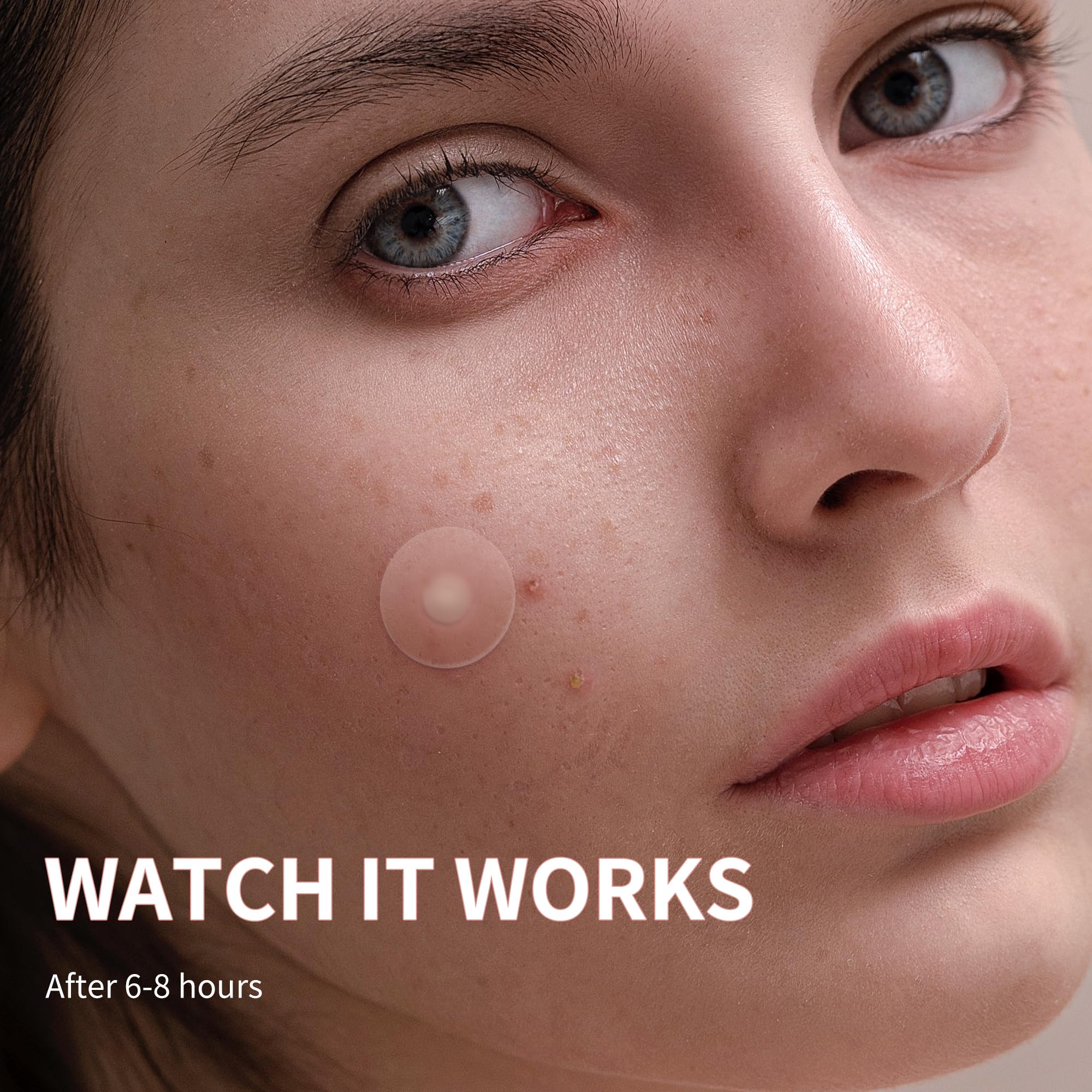 Daolyo Pimple Patches For Face, 4 Size 300 Counts Acne Patches, Hydrocolloid Patches For Covering Zits And Blemishes, Spot Stick