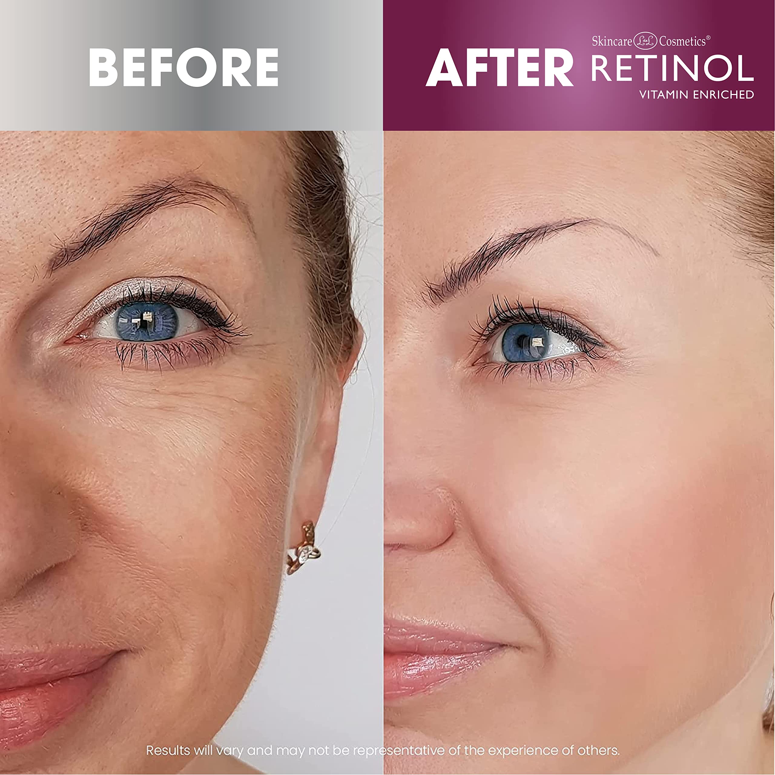 Retinol Day Cream SPF 20 - Moisturizes, Reduces Fine Lines, 1.7 Oz - Broad Spectrum Sun Protection by LdeL Cosmetics