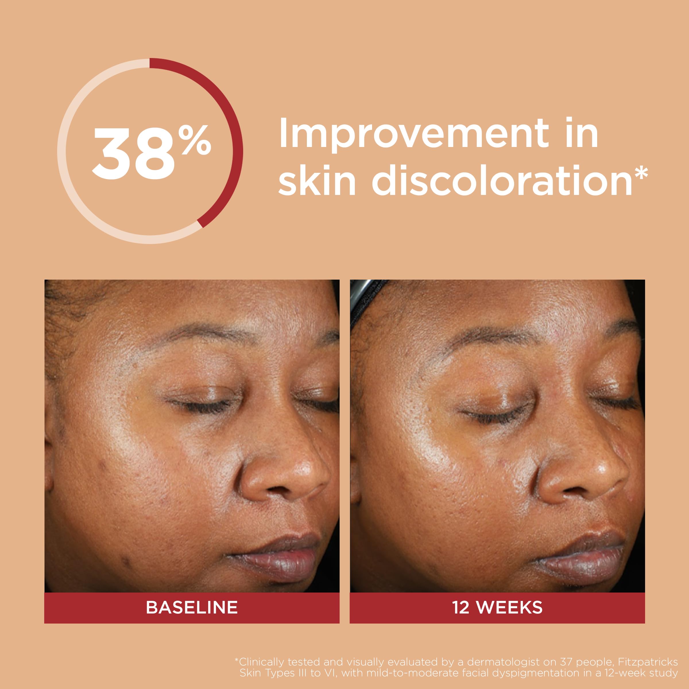 Eltamd Uv Clear Deep Tint Face Sunscreen, Spf 46 Tinted Sunscreen With Zinc Oxide, Oil-Free, For Sensitive Skin, Acne-Prone Skin