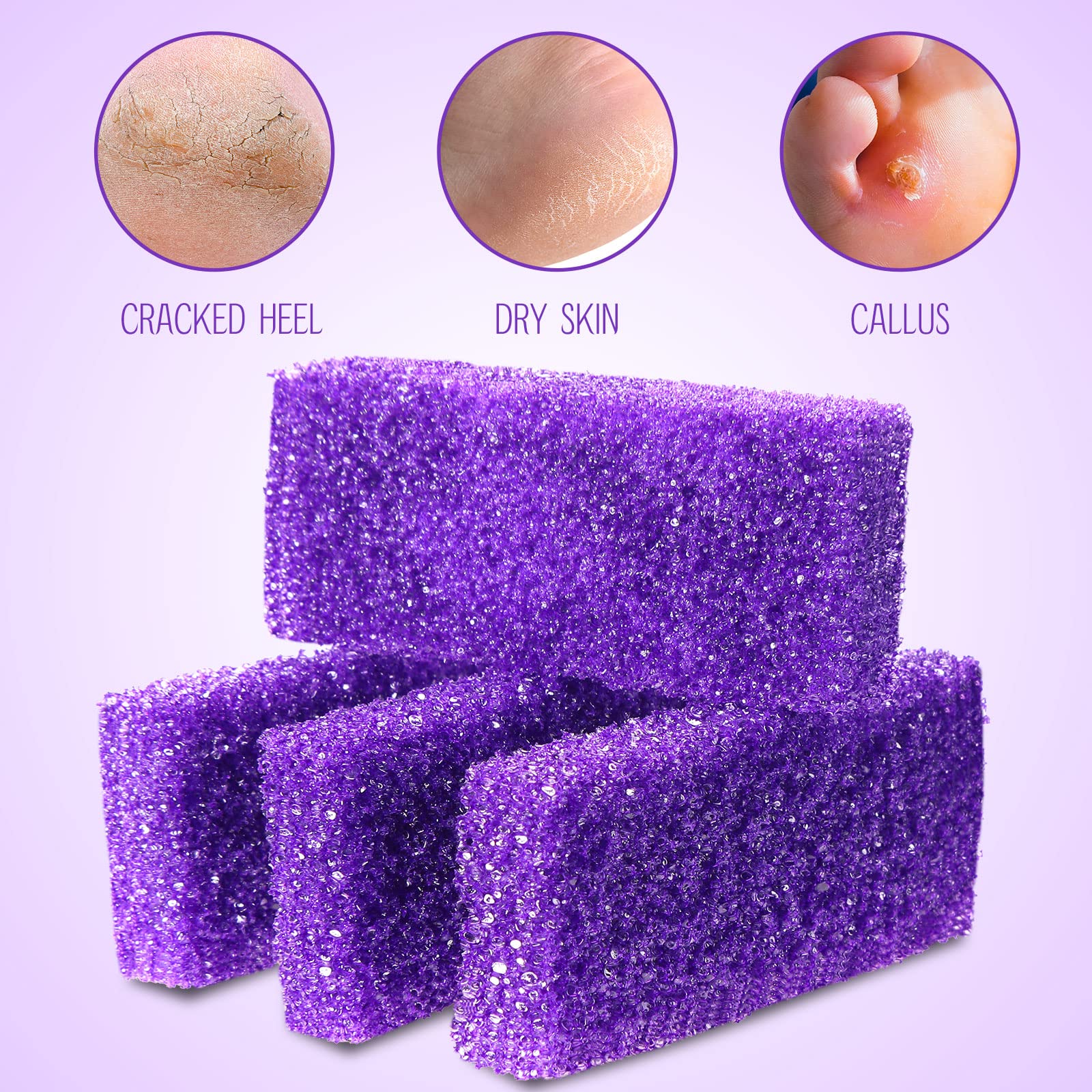 Batiyeer 100 Pcs Pumice Stone For Feet Scrubber Dead Skin Disposable Foot Pumice Foot Shower Scrubber Foot Scrubber For Heel Cut