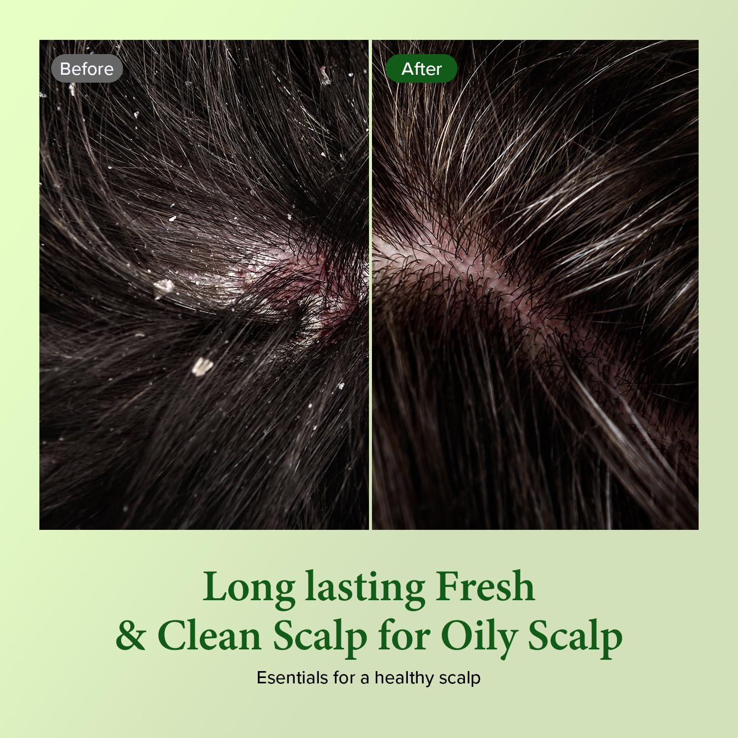 Kundal Tea Tree Deep Cleansing Hair Shampoo [White Musk] Scalp Purifying, Nature Ingredients, Tea Tree Extract, Ph Balancing And