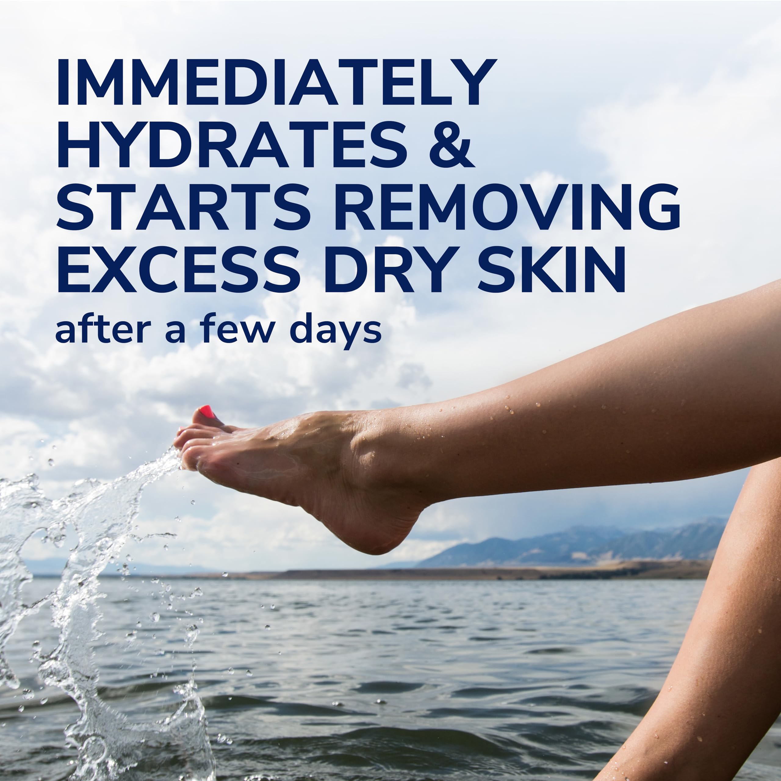 Dr Scholls Dry, Flaky Skin Remover Ultra Exfoliating Foot Lotion With Urea For Rough Dry Cracked Feet, Heal And Moisturize For H