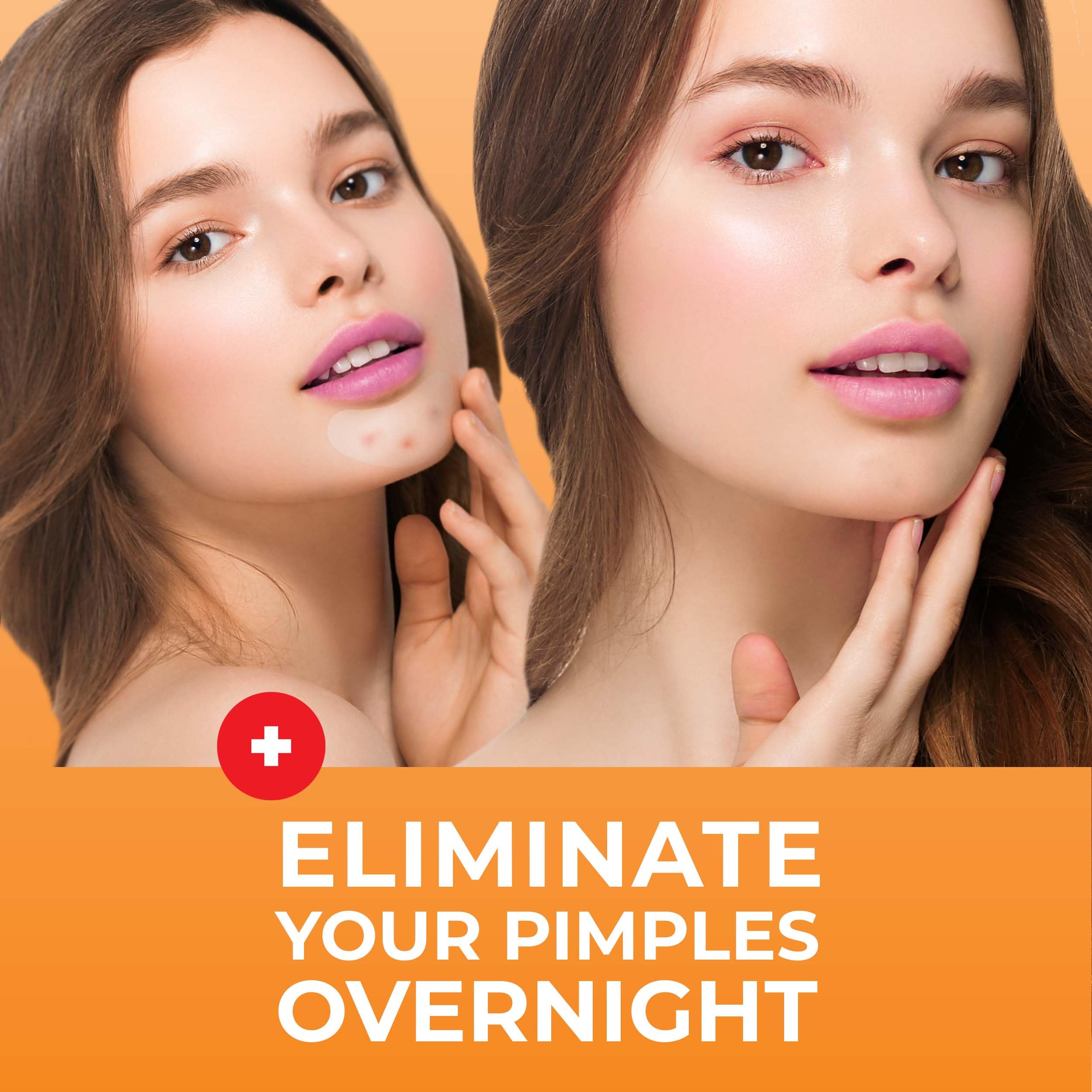 Keyconcepts Patchrx Chin Pimple Patches (12 Pack), Reduce Chin Acne Overnight With Large Hydrocolloid Acne Patches For Blemishes