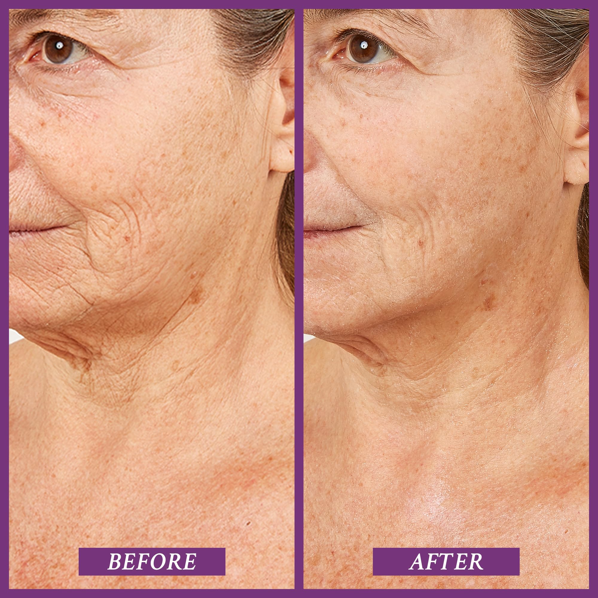 PRAI Beauty Ageless Throat & Decolletage Serum for Instantly Ageless Neck | Neck Firming and Tightening Serum | Anti-Aging Serum