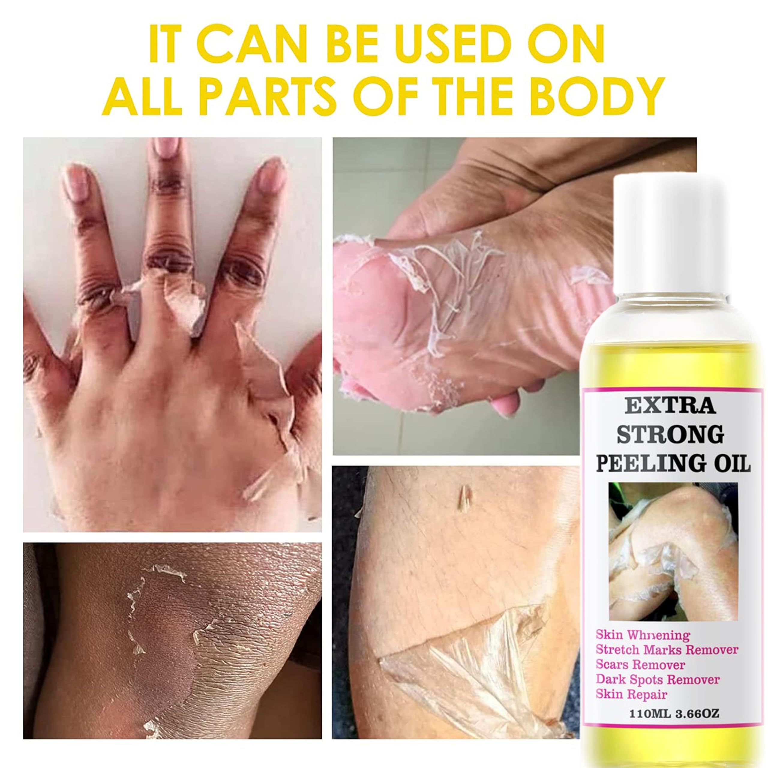 Yellow Peeling Oil, Chemical Peel Peeling Oil for Dark Skin, Strong Peeling Oil Extra Strength, Exfoliating Peeling Solution for