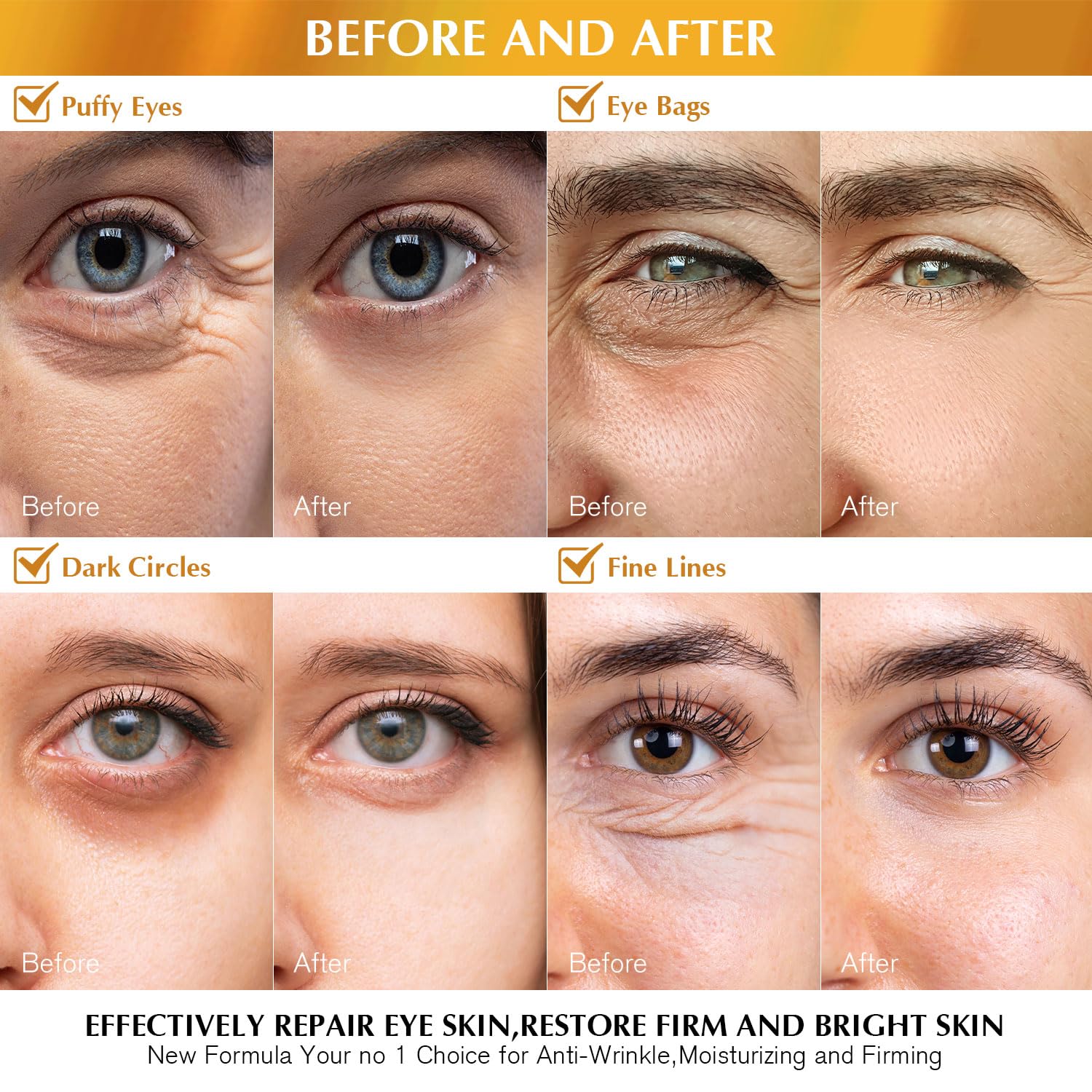 Enaskin Naturals Under Eye Patches Dark Circles Under Eye Masks For Puffiness - 24K Gold Eye Gel Pads Retinol Collagen Hyaluroni