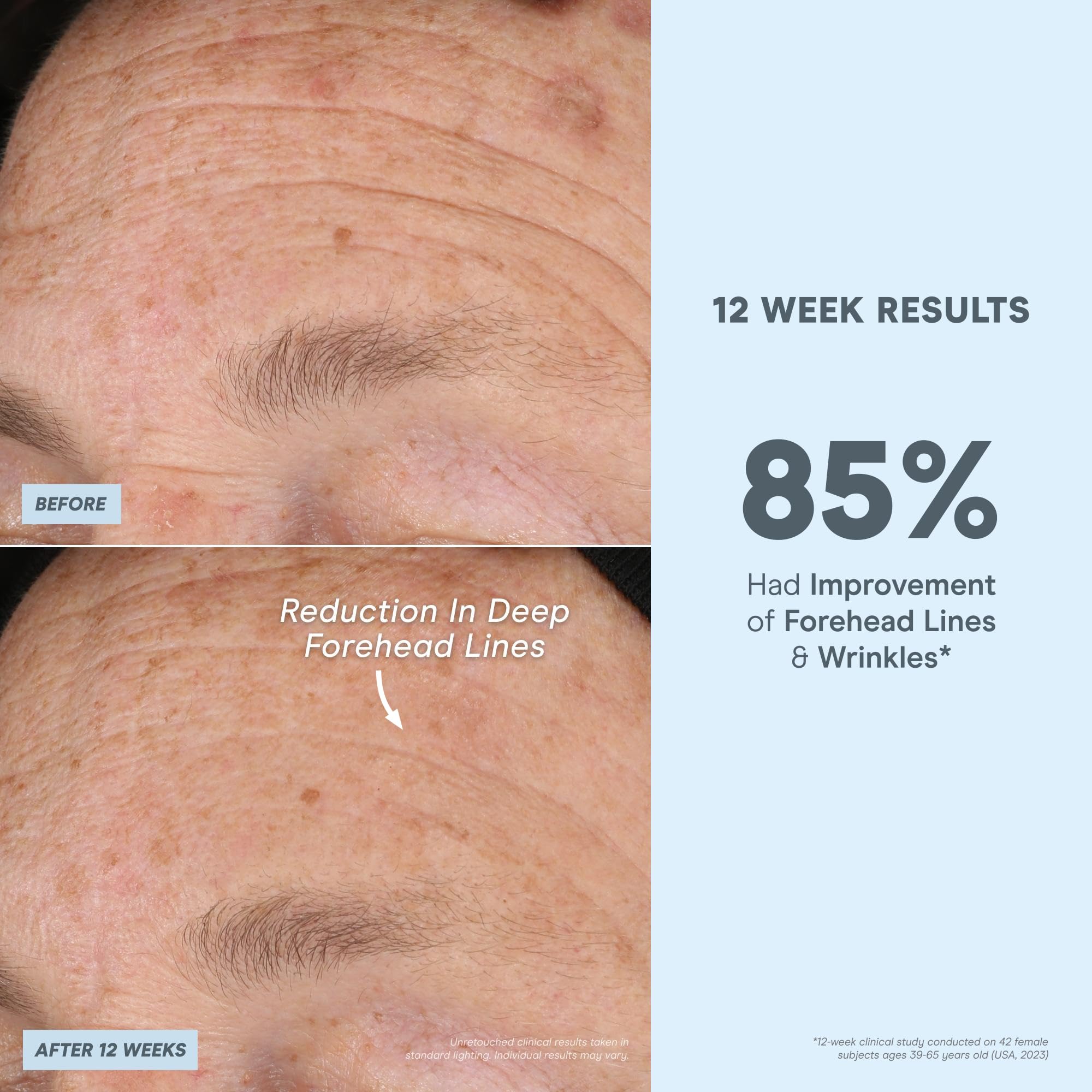 NuFACE Super Peptide Booster Face Serum - Skin Firming Peptide Serum for Fine Lines and Wrinkles - IonPlex Skin Care to Smooth,