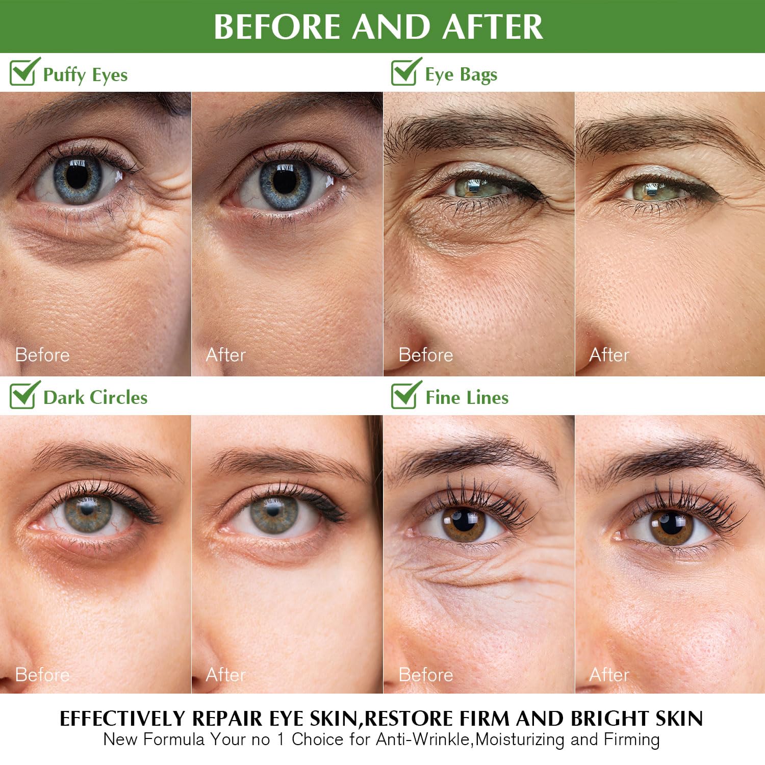 Under Eye Patches For Dark Circles: 30 Pairs Green Tea Eye Gels Pads - Reduce Eye Bags, Wrinkles & Puffy - Skin Treatment Mask R