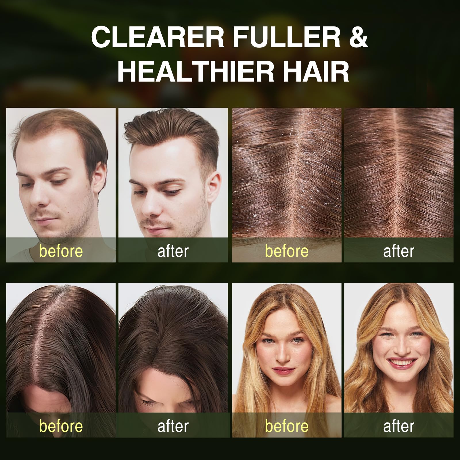 Batana Oil Hair Growth Shampoo, Strengthening Regrowth Shampoo For Men & Women With Thinning Hair & Hair Loss, Infused Rosemary,