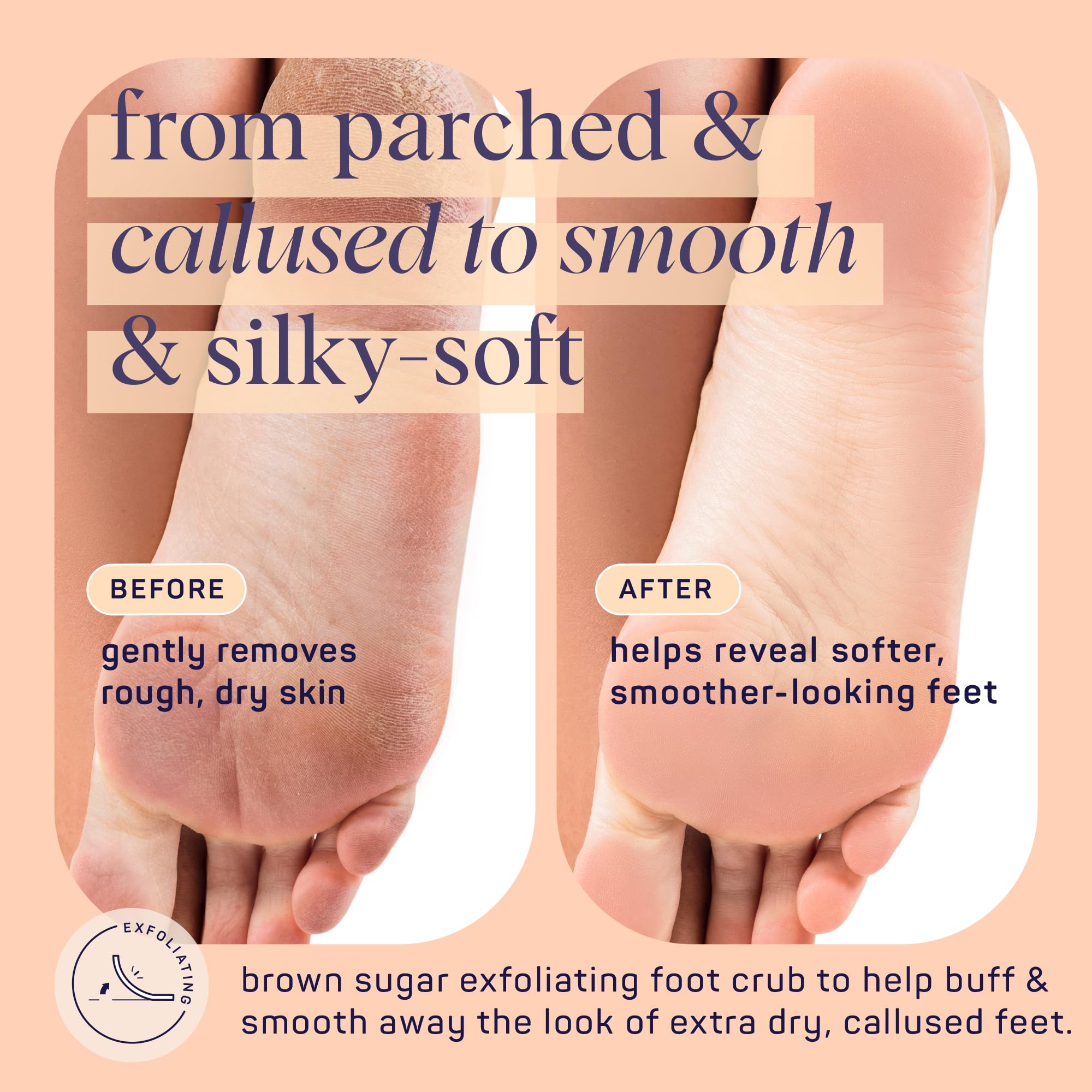 Spalife Beauty Brown Sugar Foot Scrub - Exfoliating Foot Treatment For Dryness & Roughness - Sugar Scrub For Feet - Made With Sh