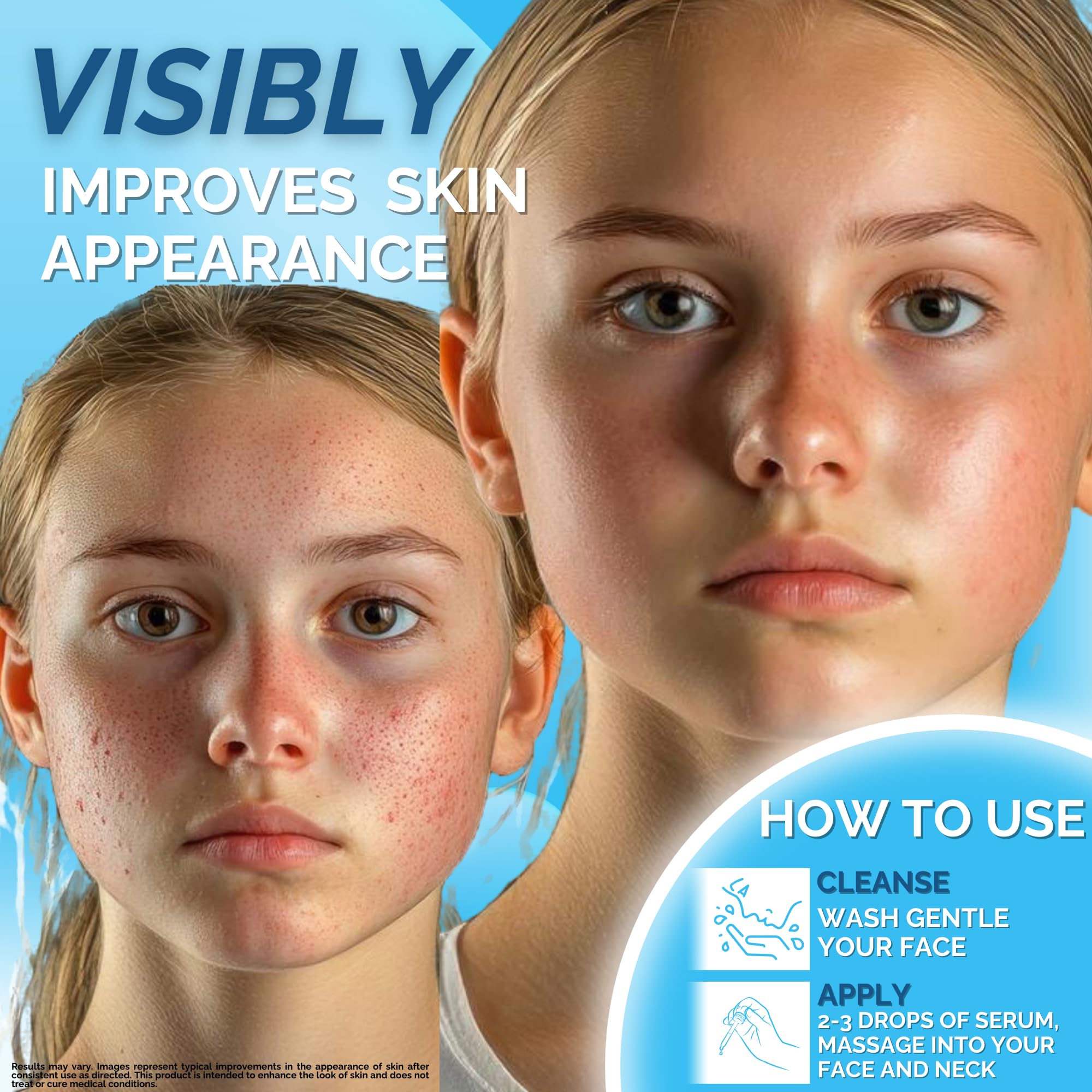 ERase Spotless Serum - Vitamin C Serum for Dark Spots with Niacinamide 5%, Korean Skin Care, Proactive Acne Treatment For Face,