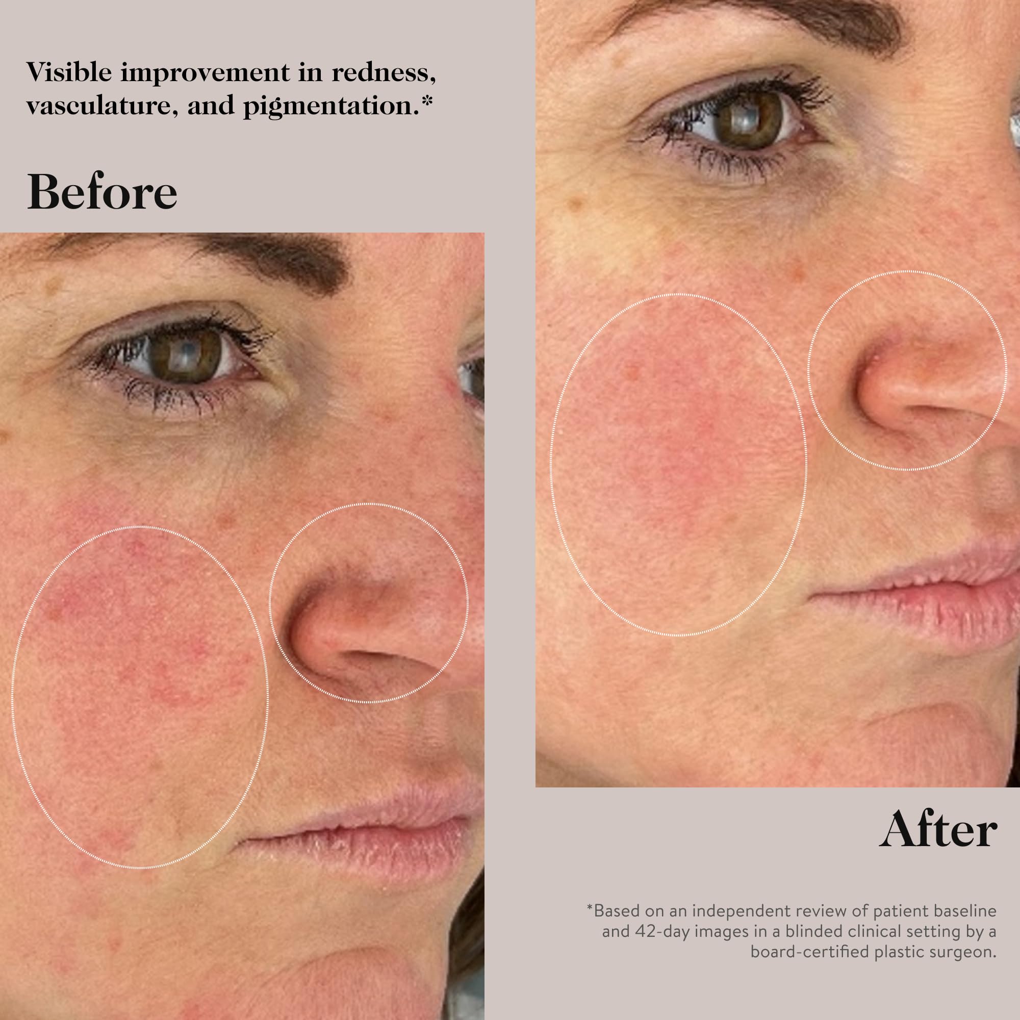 Goop Beauty Peptide Serum | Face Serum To Reduce Fine Lines & Wrinkles | Peptides, Ceramides, & Niacinamide | Anti Aging Serum T