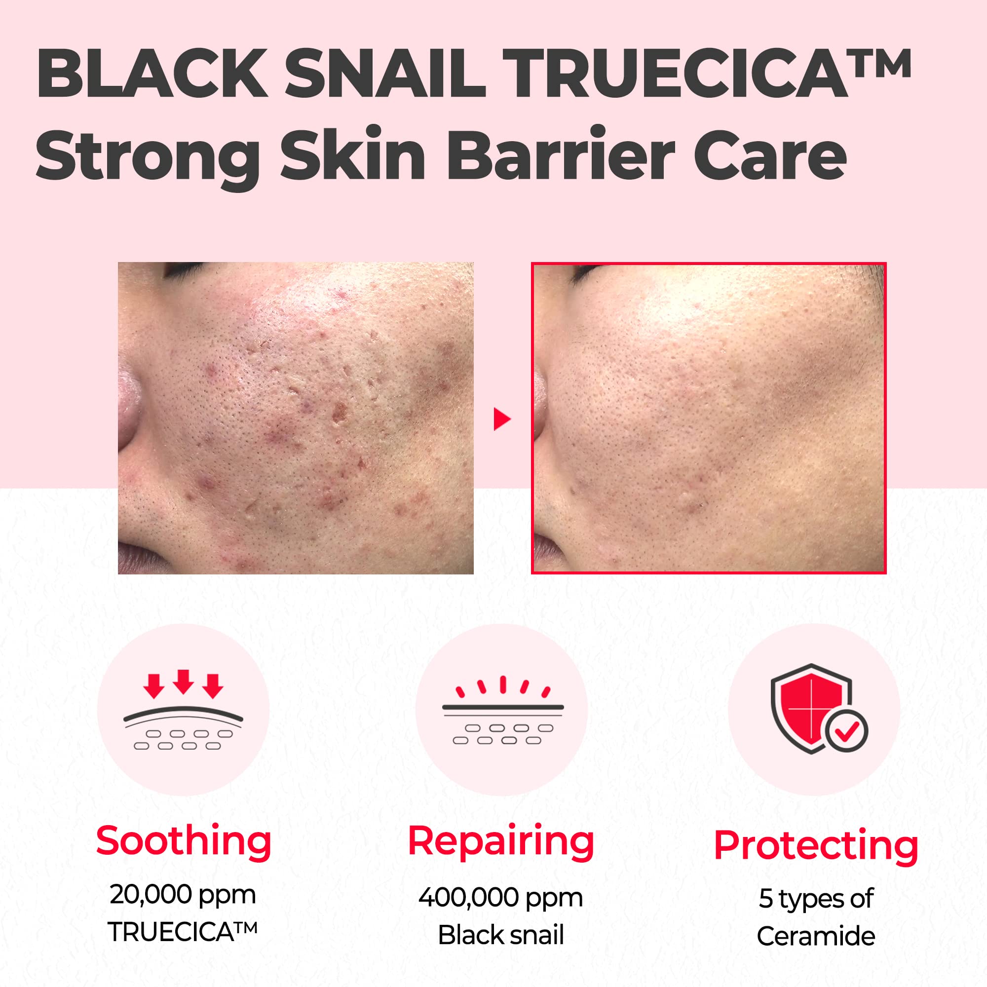 SOME BY MI Snail Truecica Miracle Repair Cream - 2.02Oz, 60ml - Made from Snail Mucin for Sensitive Skin - Daily Repair Face Moi