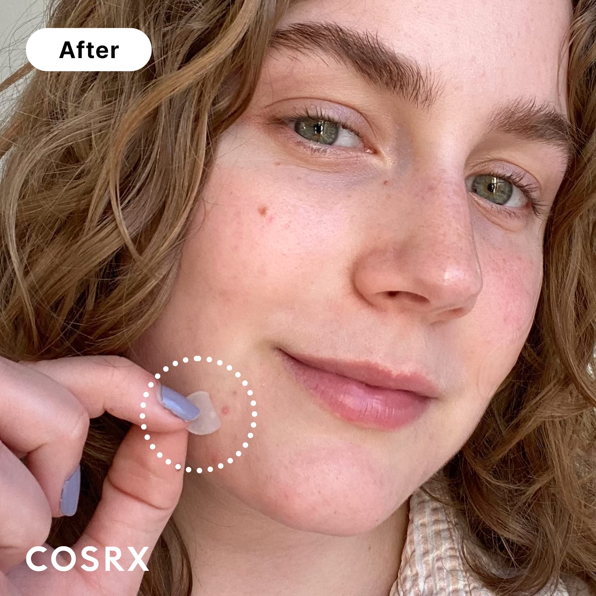 cOSRX Acne Pimple Patch (96 count) Absorbing Hydrocolloid Spot Treatment Fast Healing, Blemish cover, Three Sizes