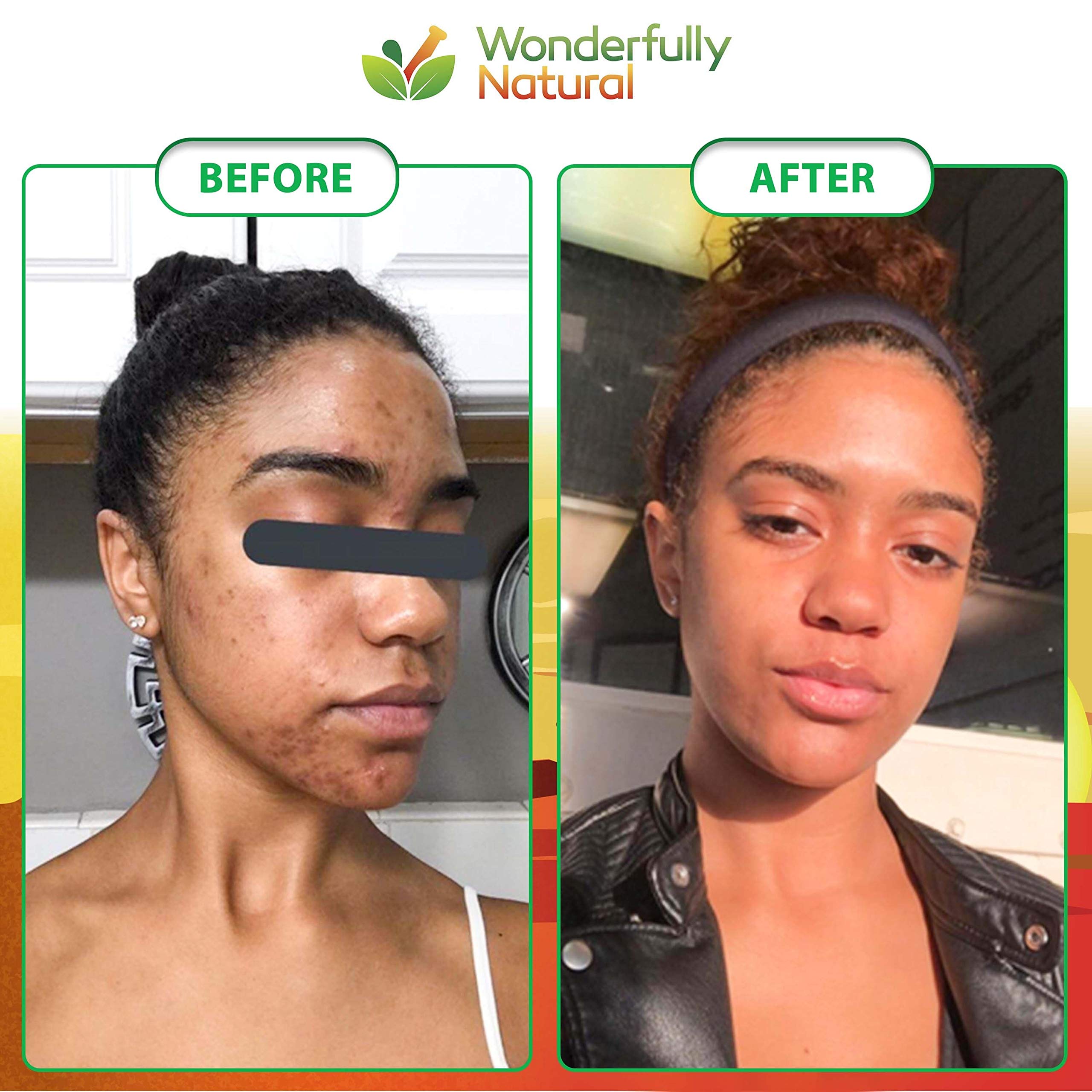 Organic African Black Soap - For Acne & Dark Spots | Natural Vegan and Cruelty Free - Satisfaction Guarantee 1lb bar | 90 day Su