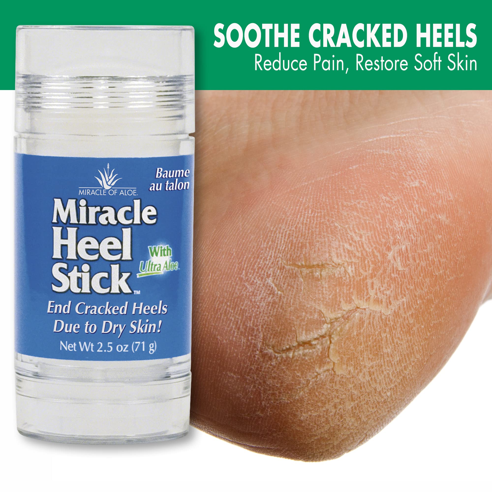 Miracle Of Aloes Miracle Heel Stick - Quick Relief For Rough, Dry, Cracked Heels - Intensive Therapeutic Balm For Severe Dry Fee