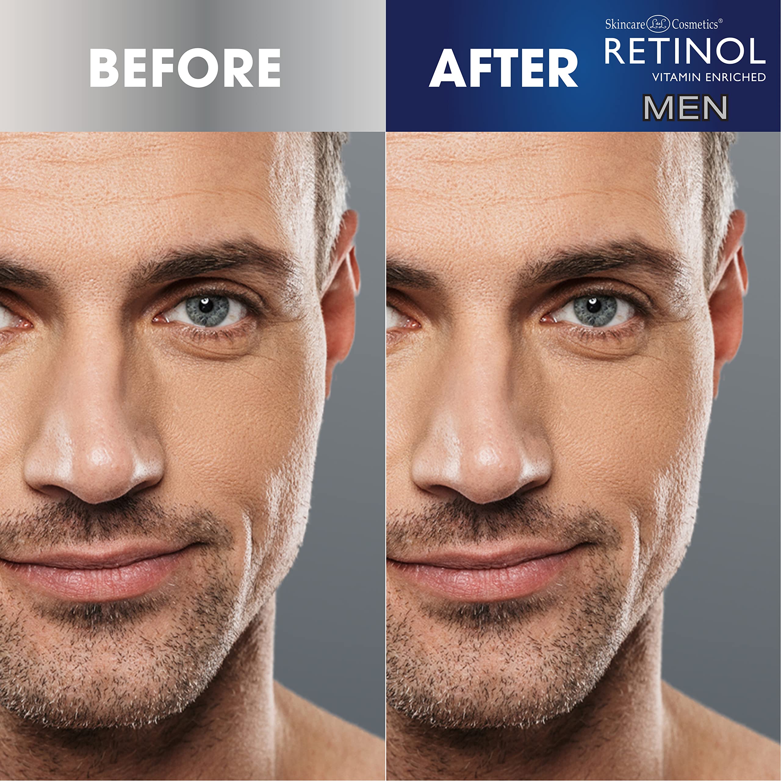 Retinol Mens Eye Cream - The Original Retinol Eye Treatment For Men - Targets Under-Eye Area to Reduce Puffiness & Dark Circles,