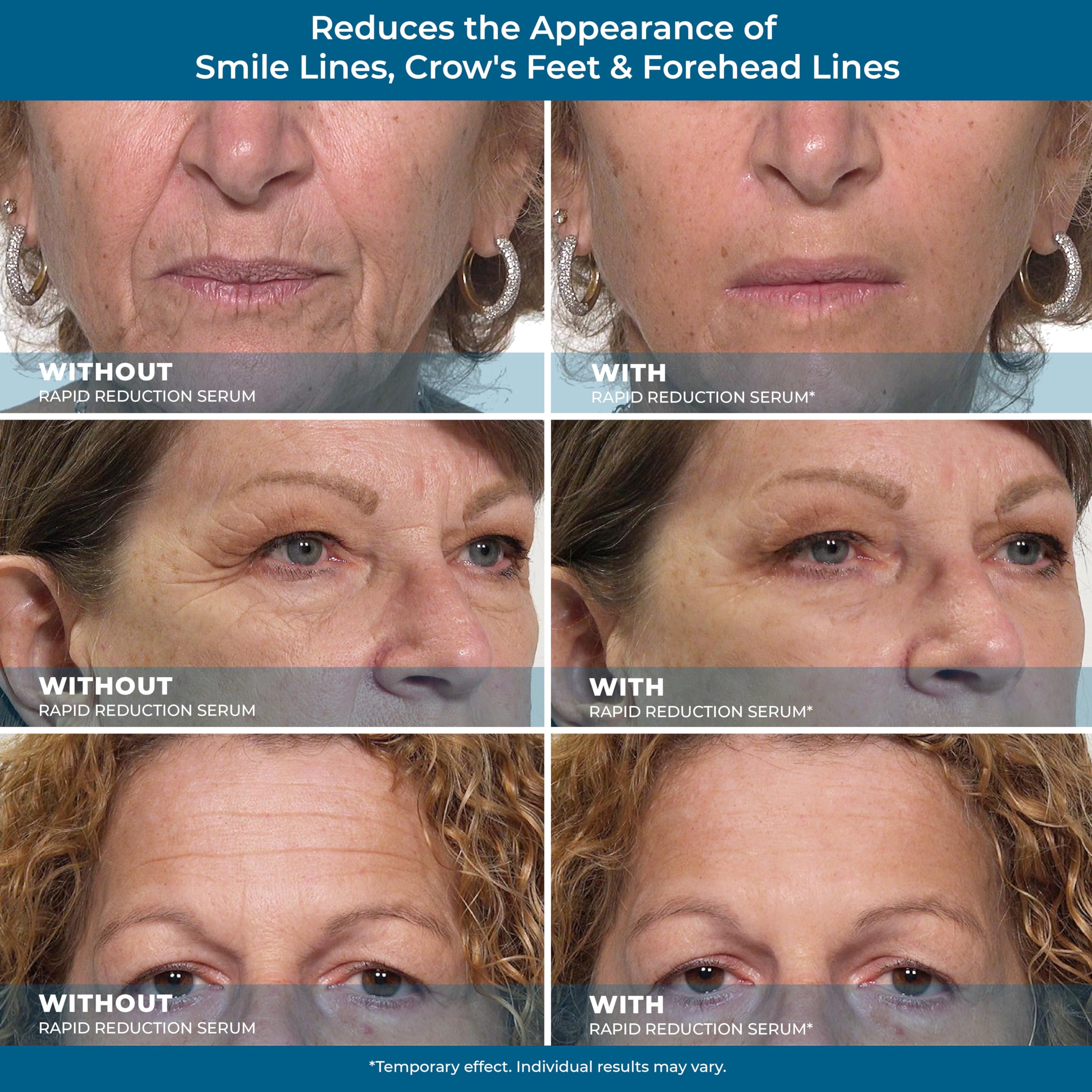 Plexaderm Rapid Reduction Eye Serum - Advanced Formula Anti Aging Visibly Reduces Under-Eye Bags, Wrinkles, Dark Circles, Fine L