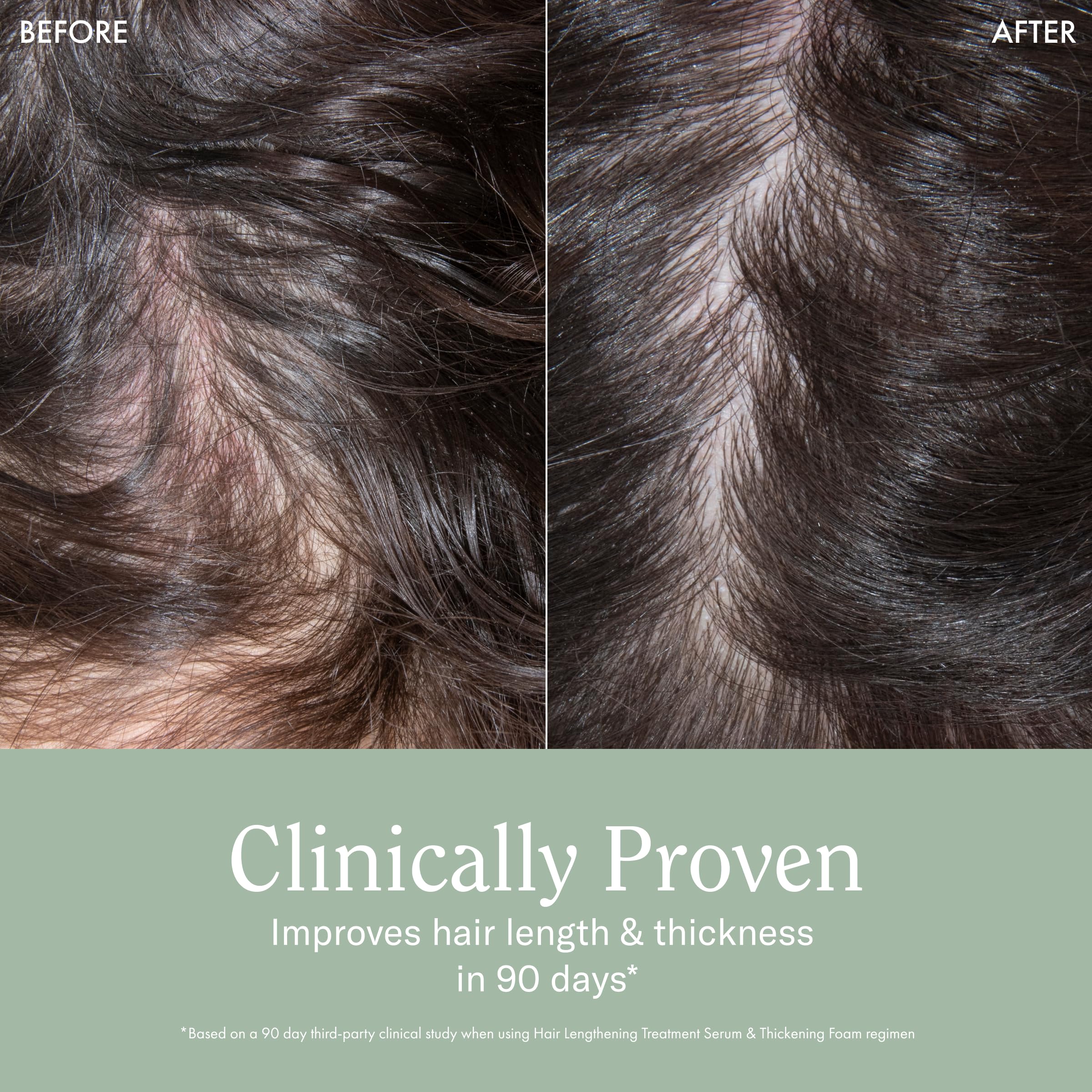Rizos Curls Hair Lengthening Treatment Serum, Fortifies At Root For Healthy Scalp Microbiome Promoting Length, Supportes Longer