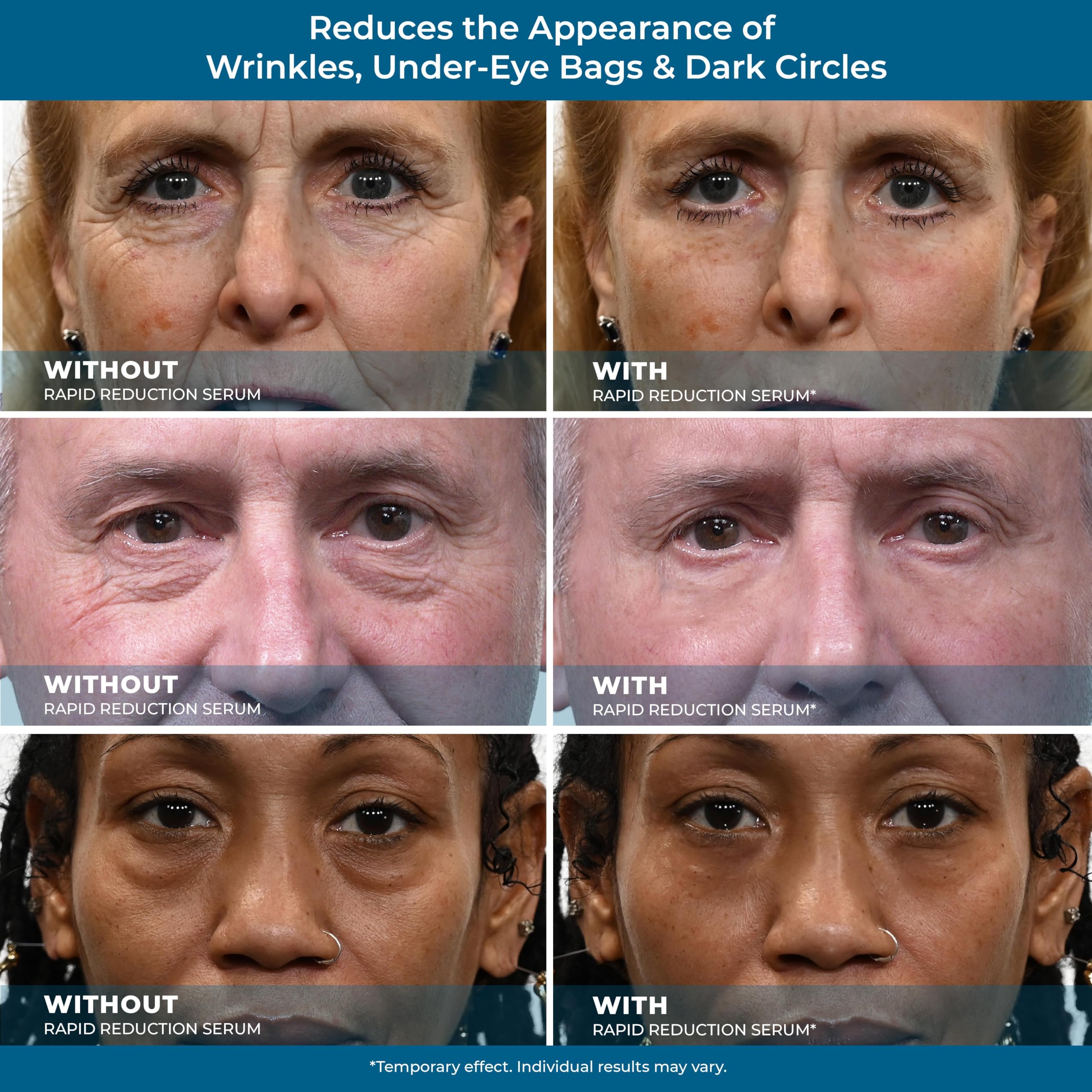 Plexaderm Rapid Reduction Eye Serum - Advanced Formula Anti Aging Visibly Reduces Under-Eye Bags, Wrinkles, Dark Circles, Fine L