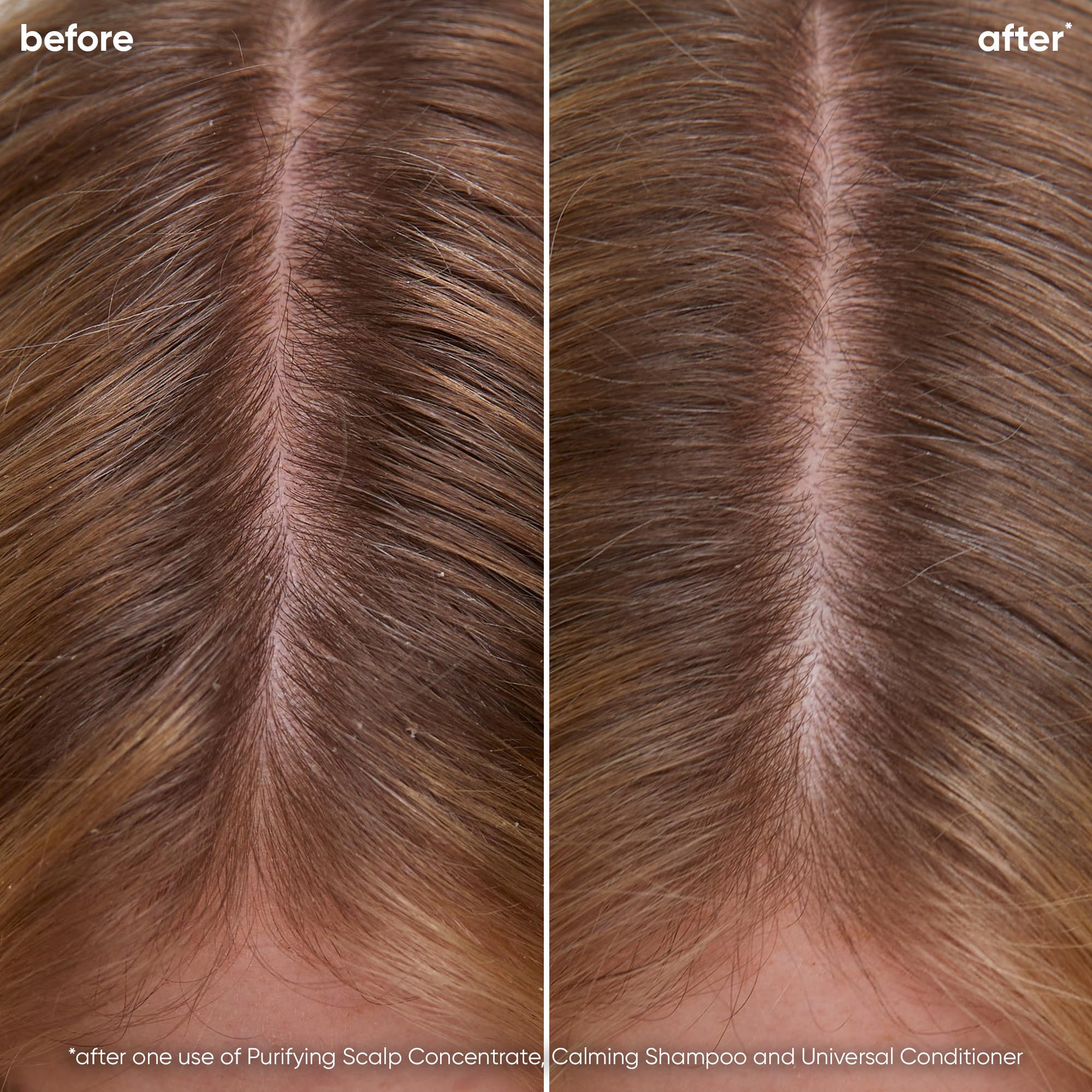 Biolage Scalp Sync Calming Shampoo | Calms & Hydrates Dry or Irritated Scalp | Paraben & Silicone Free | For Sensitivity Control