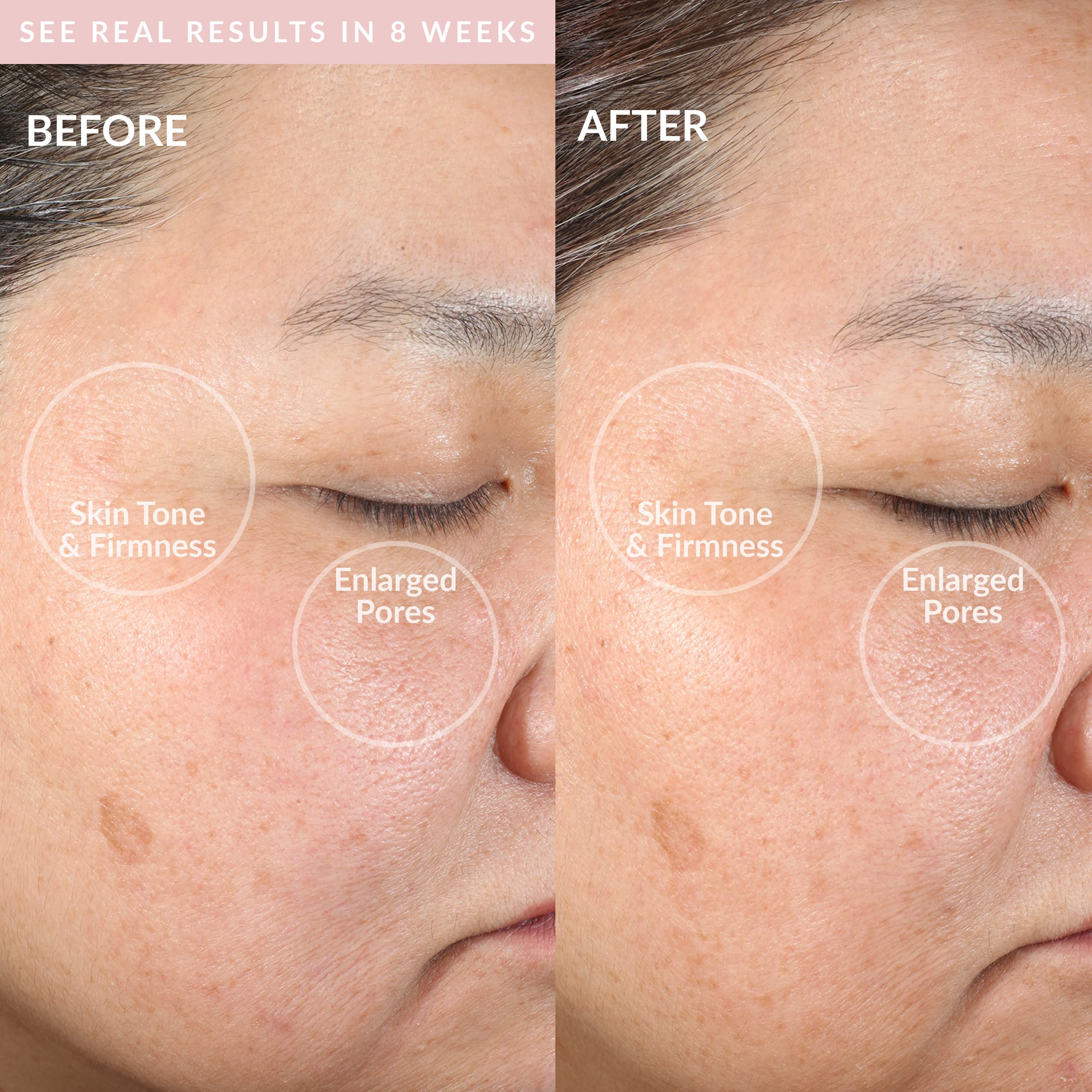 Pmd Clean - Smart Facial Cleansing Device With Silicone Brush & Antiaging Massager - Waterproof - Sonicglow Vibration Technology