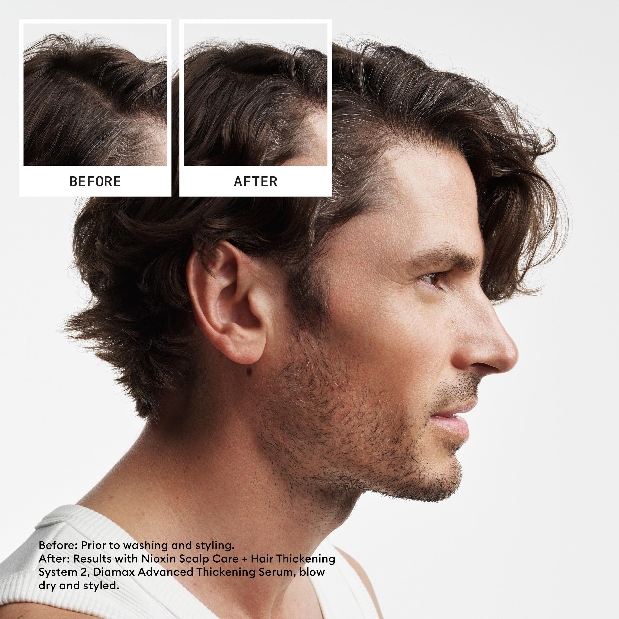 Nioxin Scalp + Hair Thickening System 2 Shampoo | For Natural or Untreated Hair with Progressed Thinning | With Niacinamide and
