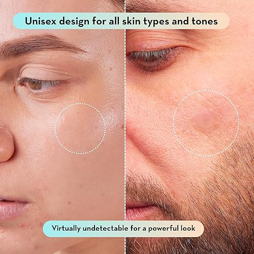 Le Gushe Pimple Patches For Face (132 Dots) - Hydrocolloid Acne Patch For Zits And Blemishes - Invisible Spot Cover Stickers For