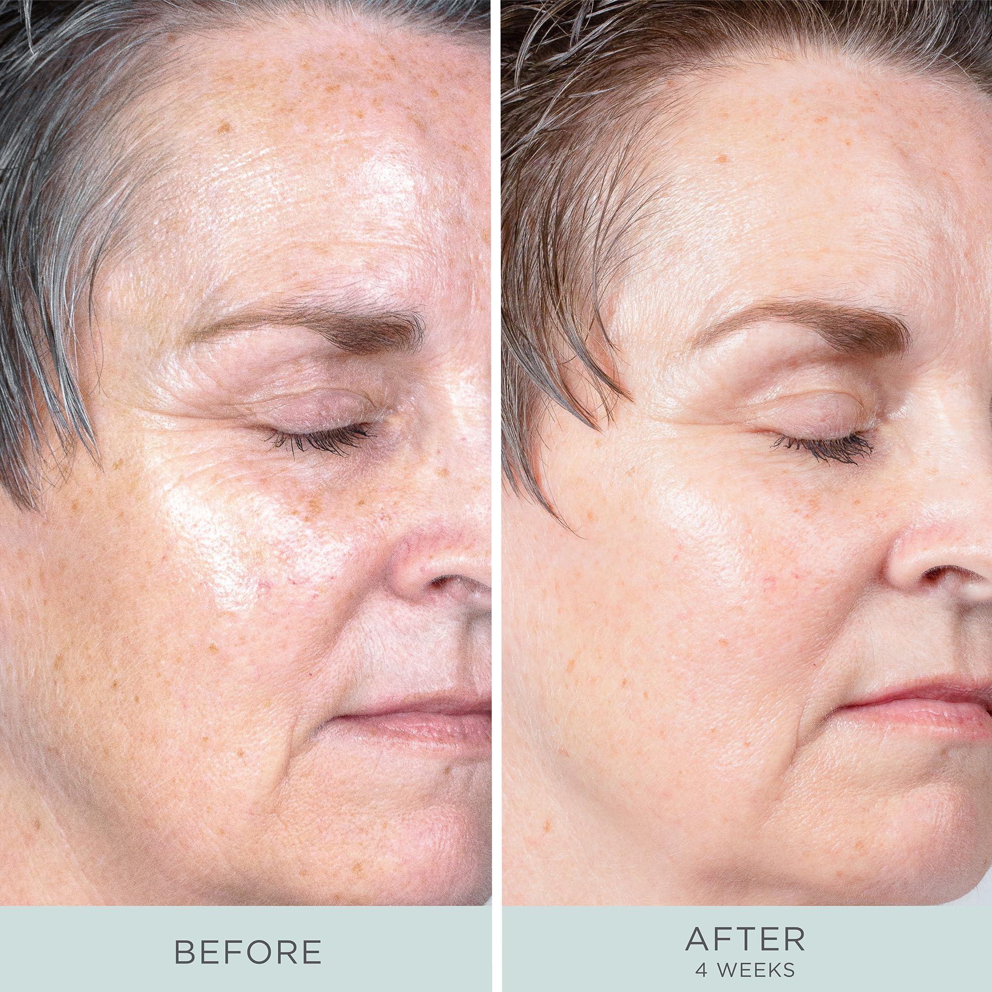 PR Beauty Ceretin Boost Age Defying Retinol Serum, 1 oz
