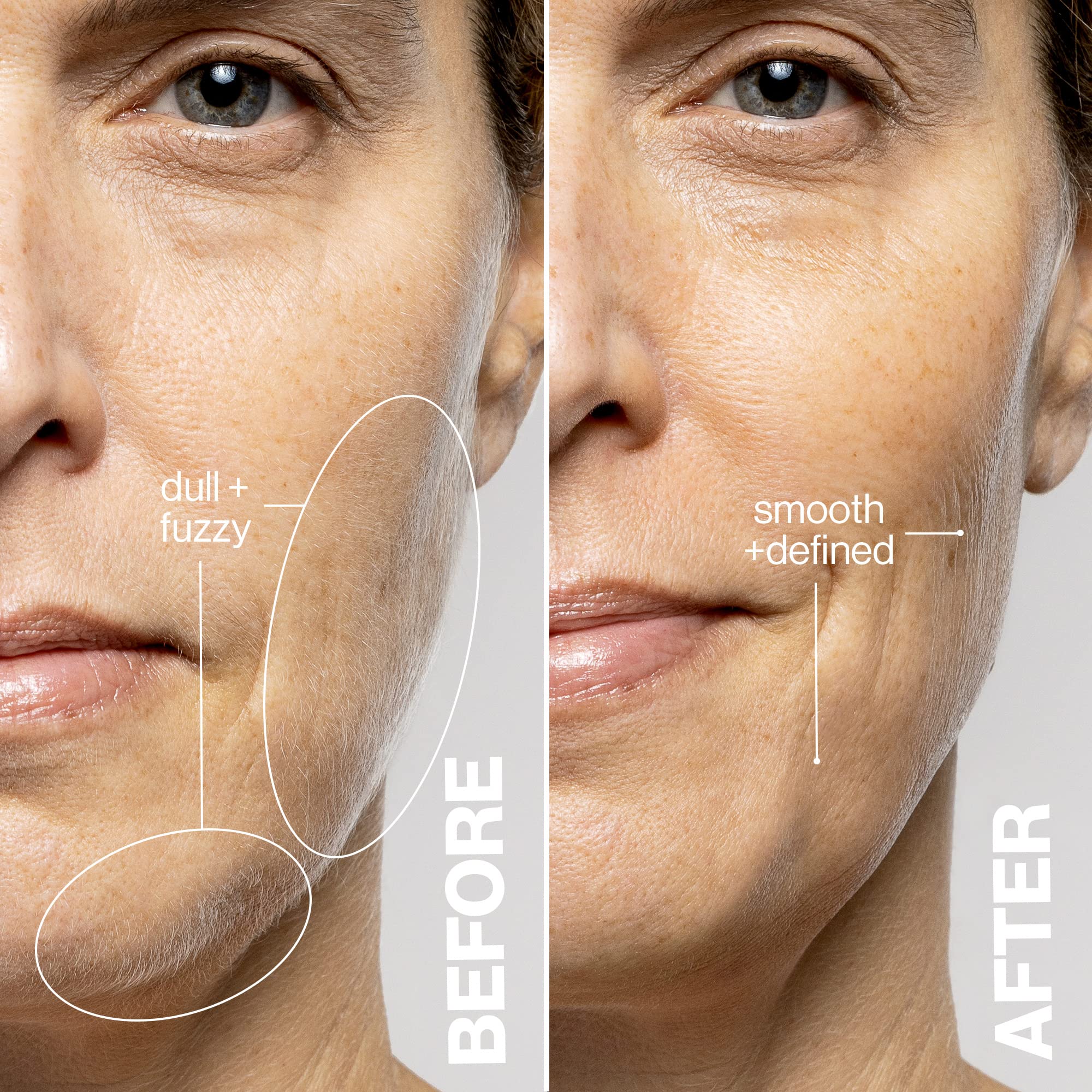 DERMAFLASH LUXE plus Device, Anti Aging, Exfoliation, Hair Removal, and Dermaplaning Tool with Sonic Edge Technology and 4 Weeks