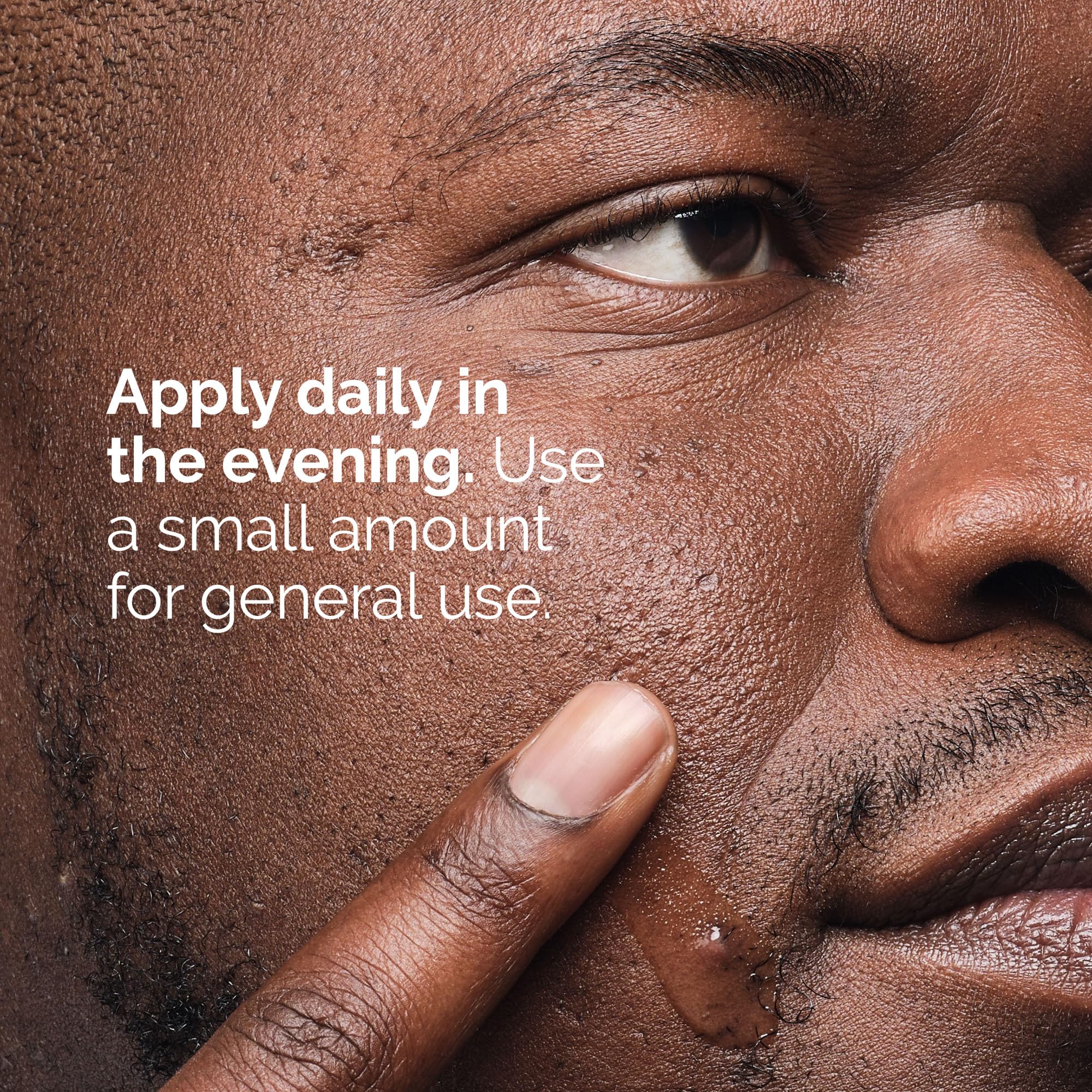 The Ordinary Salicylic Acid 2% Solution, Acne-Fighting Serum For Blemish-Prone Skin, 1 Fl Oz