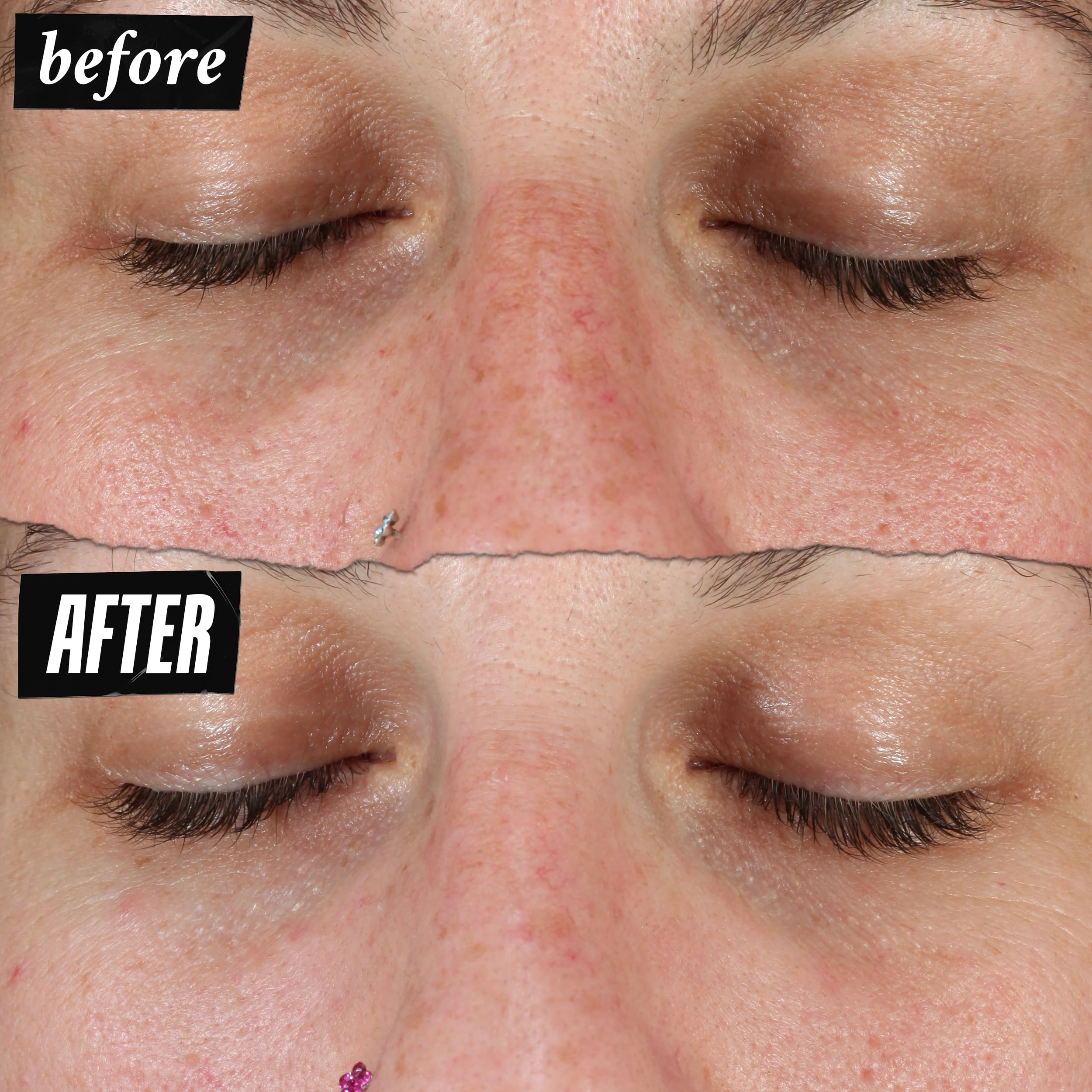 Kiehl'S Clearly Corrective Dark Spot Serum, Brightening Facial Serum, Reduces Hyperpigmentation & Post-Acne Marks, With Vitamin
