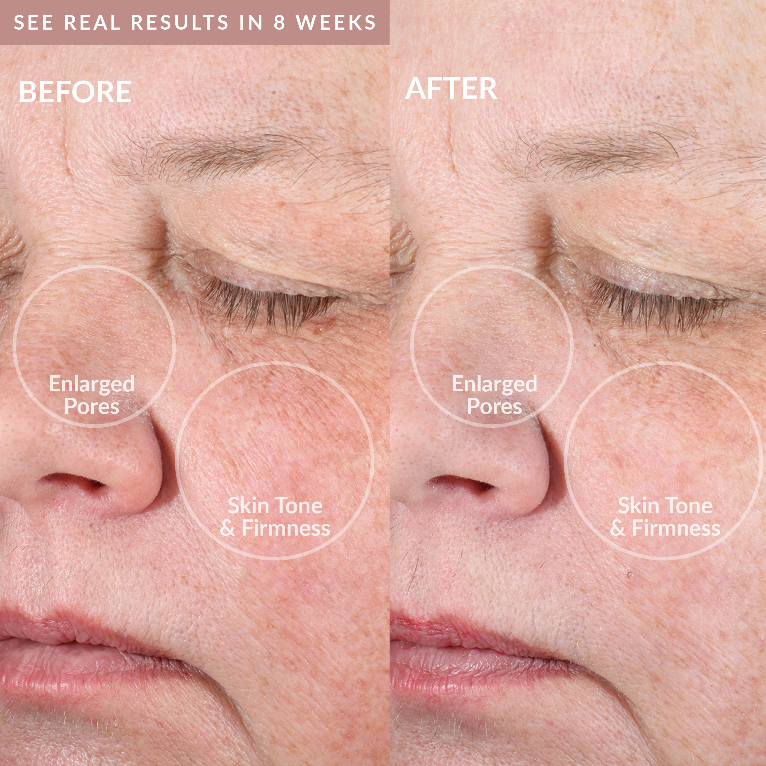 Pmd Clean Pro Gold - Smart Facial Cleansing Device With Silicone Brush & 24K Gold Activewarmth Anti-Aging Massager - Waterproof