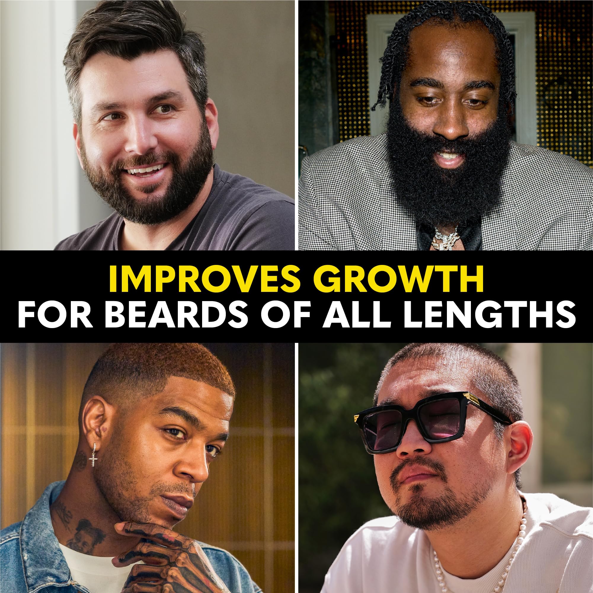 Beard Club - Beard Growth Oil - Grow A Thicker Fuller Beard & Hair, Fill in Patches - Healthy Natural Castor, Coconut and Avocad