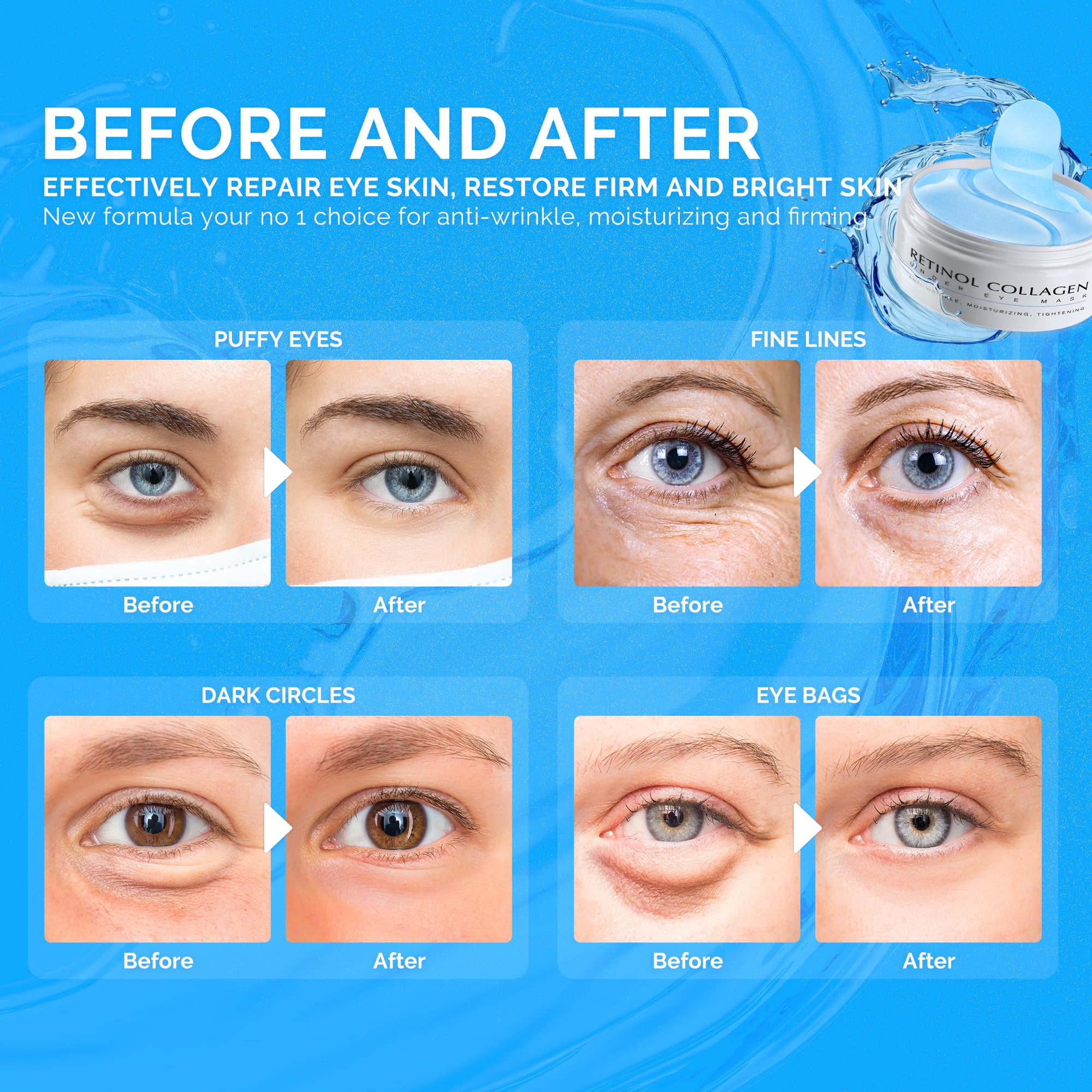 Enaskin Naturals Under Eye Patches For Dark Circles: 30 Pairs Retinol Collagen Eye Gels Mask - Reduce Wrinkles Puffy & Bags - Sk