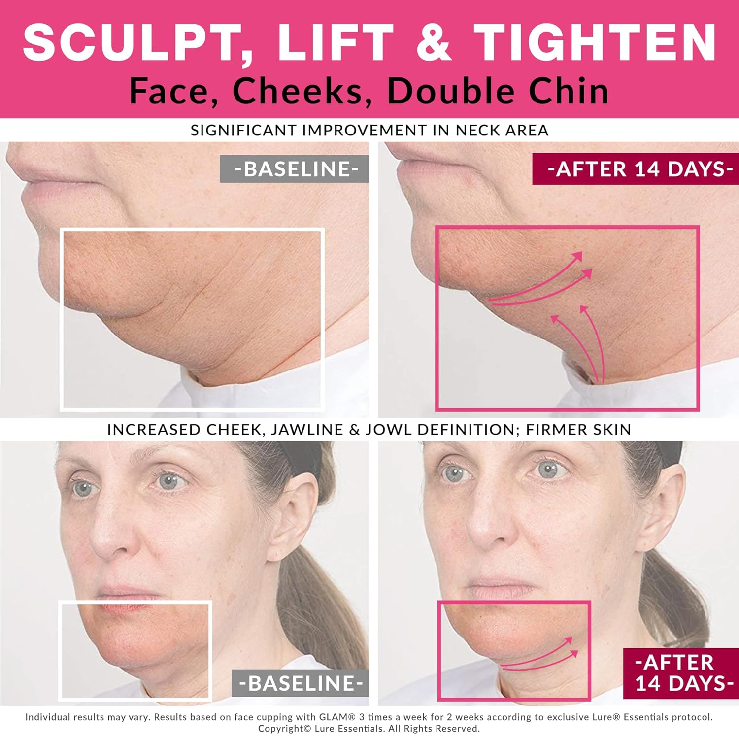 GLAM Facial Cupping Set, Face Eyes Lips